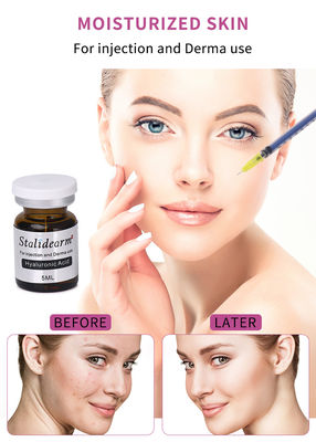 Wsparcie skóry Kwas hialuronowy Mikronygła Mezoterapia Serum przeciwstarzenie się Ampułka wybielająca Serum Wstrzyknięcie wypełniacza skórnego
