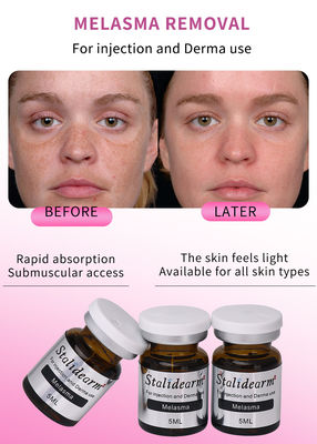 Wyrzucanie rękawicy na szczepionkach stacjonarnych Melasma Meso Serum Reducing Fine Line Smoothing Moisturising Skin Serum Filler Injection