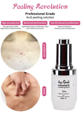 Profesjonalny zestaw serum do łuszczenia skóry Produkty do pielęgnacji skóry Czyszczenie Odnawianie skóry Revitalizuj rozwiązanie do łuszczenia skóry