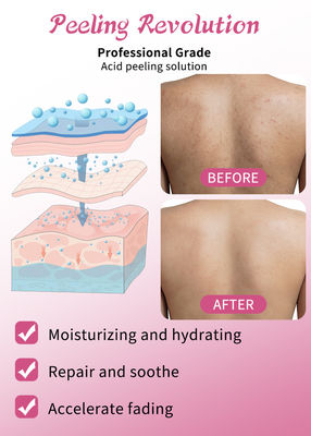 Profesjonalny zestaw serum do łuszczenia skóry Produkty do pielęgnacji skóry Czyszczenie Odnawianie skóry Revitalizuj rozwiązanie do łuszczenia skóry