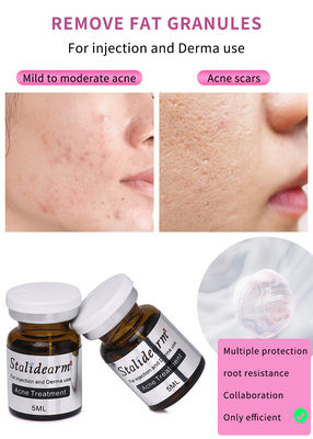 Stalidearm Oil Control and Soothing Skin Booster Serum do naprawy trądziku i oczyszczania blizn