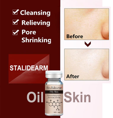 Organiczne serum ziołowe przeciw trądzikowi Dostosowana etykieta Dermapen Face Essence dla skóry tłustej
