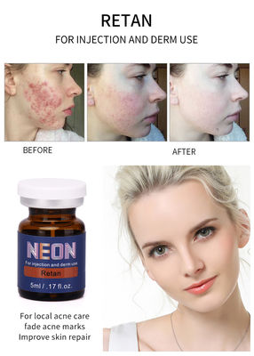 Neon Meso Therapy Serum Injection 5ml Serum do leczenia trądziku Pure Essence