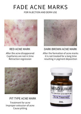 Luksusowa mezoterapia iniekcyjne serum młodości Red Spots Skin Acne Injection Treatment