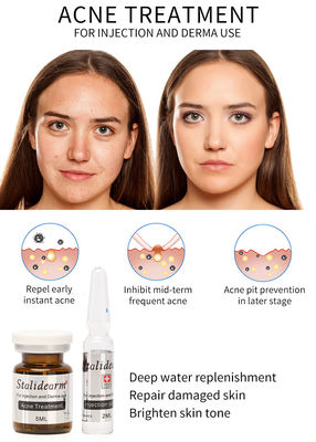 Serum do wstrzykiwań do mezoterapii Exosome Skin Booster France Original Stalidearm do leczenia trądziku