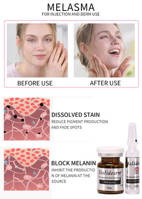 Melasma Injection Użyj serum Bezpieczny i dobry efekt Mezoterapia 5 ml/butelka zestawu serum